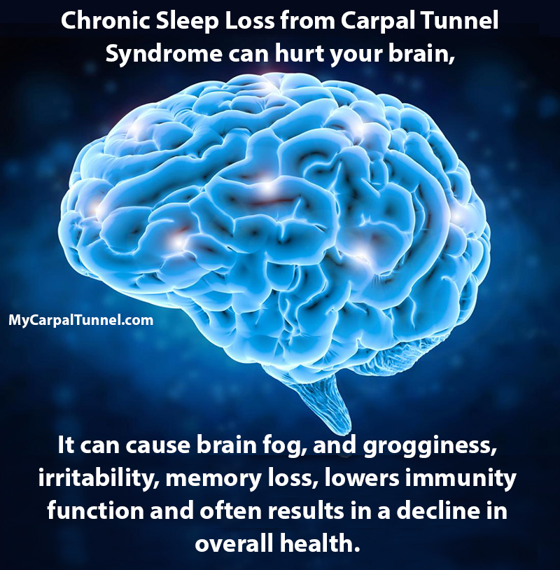 chronic sleep loss from carpal tunnel can affect your health