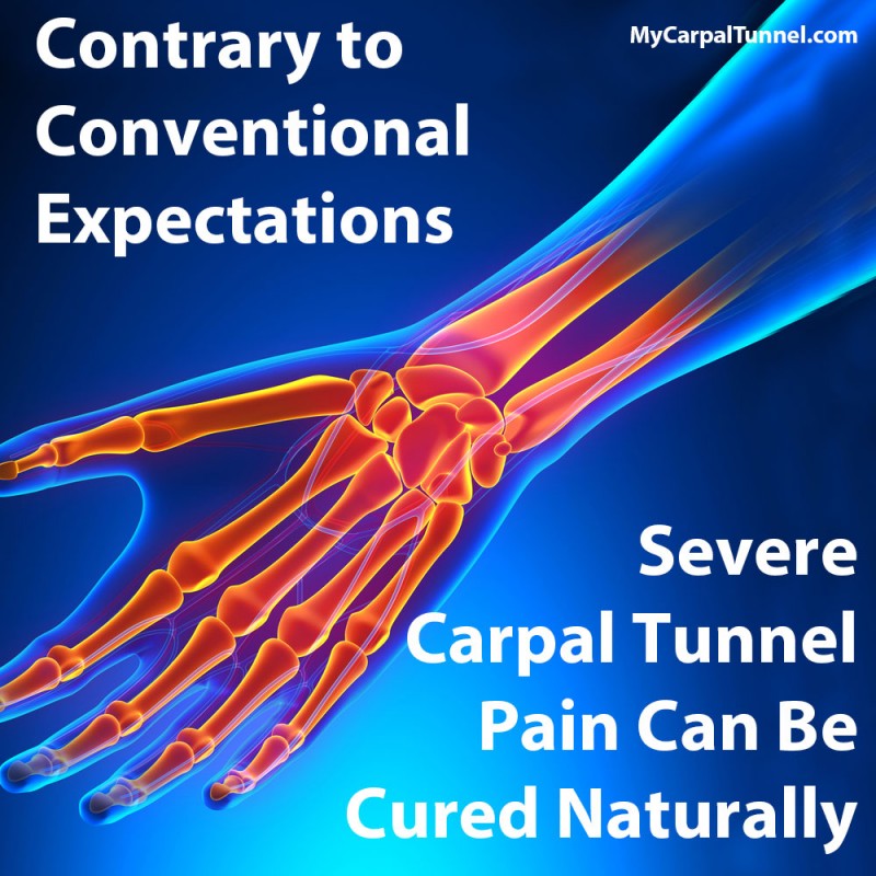 Severe Carpal Tunnel Pain Cured Without Surgery The Carpal Solution