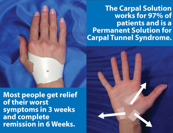 1-1-Carpal-Solution-Hand-Permanent-Solution-for-Carpal-Tunnel-Treatment-600×461