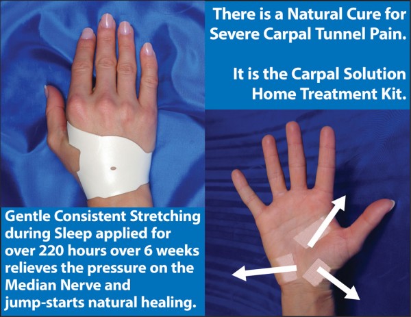there is a natural cure to severe carpal tunnel pain