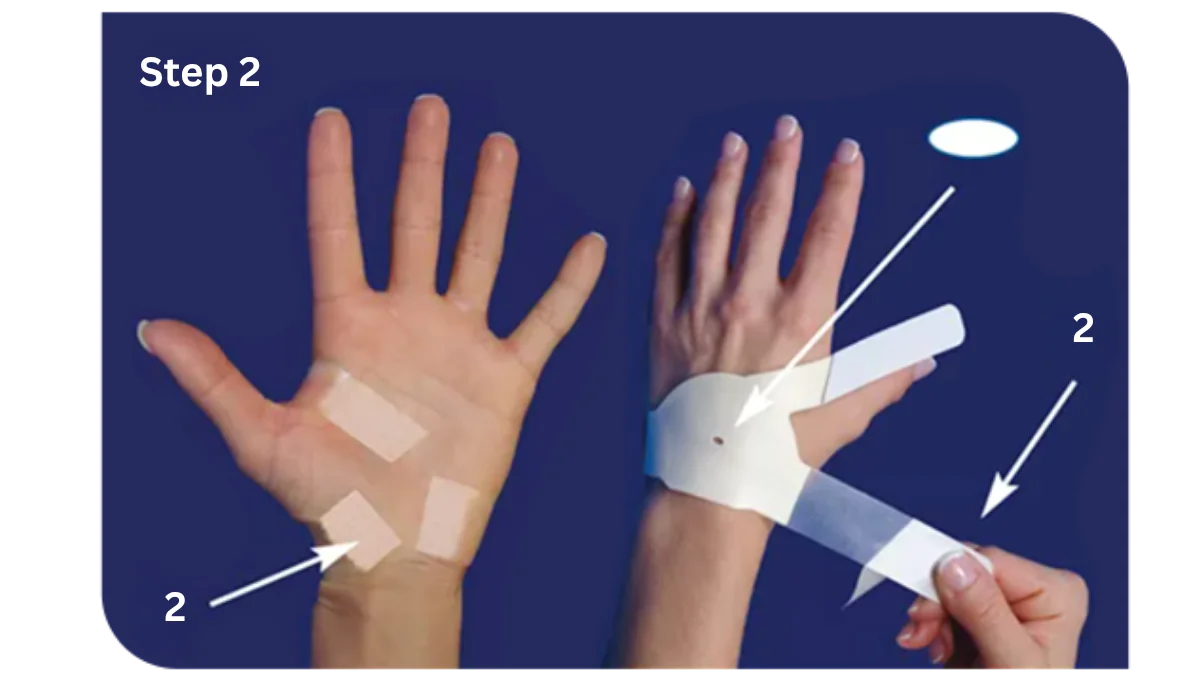 How to Apply The Carpal Solution Treatment 8 Left Hand Instructions Step2