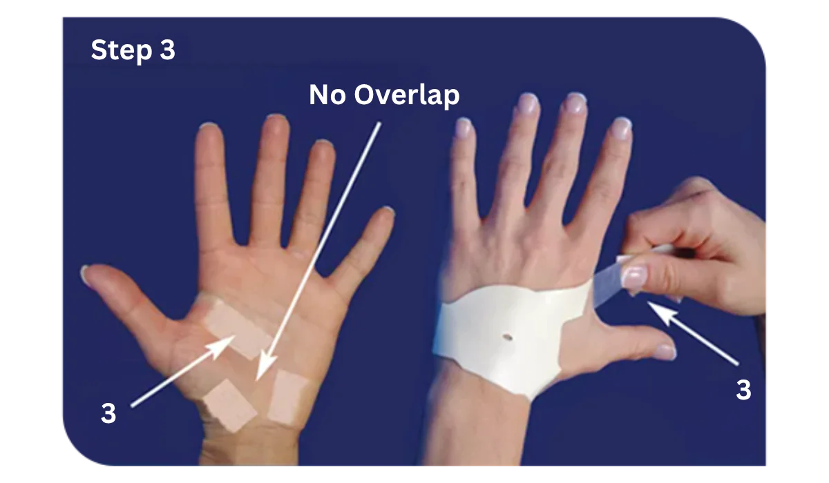 How to Apply The Carpal Solution Treatment 9 Left Hand Instructions Step3