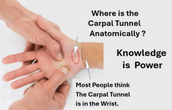 Where is the Carpal Tunnel Anatomically? Most people are confused. They think it is in the wrist, but it is actually in the base of the palm between the to major muscles of the hand. Anatomy of the Carpal Tunnel and surrounding soft tissue.