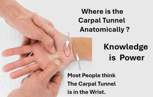 Where is the Carpal Tunnel Anatomically? Most people are confused. They think it is in the wrist, but it is actually in the base of the palm between the to major muscles of the hand.