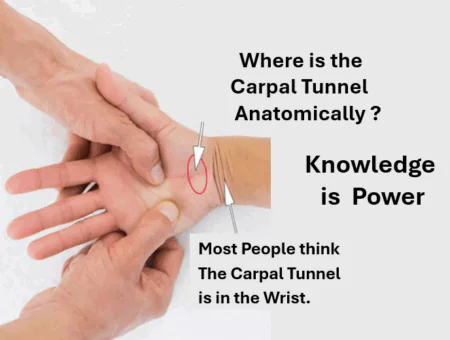 Anatomy of the Carpal Tunnel and Surrounding Soft Tissue 4 Where is the Carpal Tunnel Anatomically? Most people are confused. They think it is in the wrist, but it is actually in the base of the palm between the to major muscles of the hand. Anatomy of the Carpal Tunnel and surrounding soft tissue.