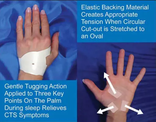 Is there a Natural Treatment for Carpal Tunnel Syndrome? 4 Natural Treatment