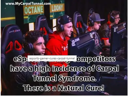 eSports Competitor Cures Carpal Tunnel with Home Treatment Developed by Doctors 3 eSports Competitor have a high incidence of Carpal Tunnel Syndrome. There is a Natural Cure!