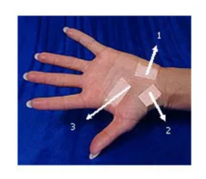 Carpal Tunnel Treatment