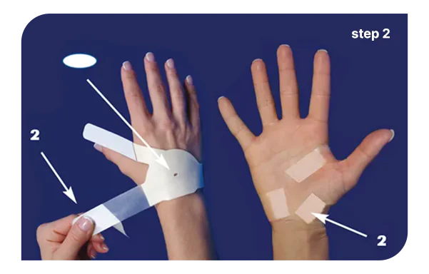 Home Remedy For Carpal Tunnel Syndrome 5 how to apply part 2