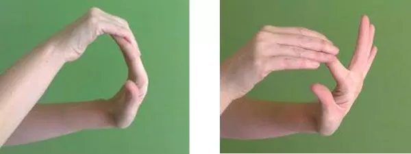 Carpal Tunnel Syndrome Exercises