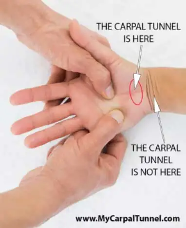 What is Carpal Tunnel? 3 location of the carpal tunnel