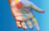 1 Carpal Tunnel Synddrome Median Nerve Path of pain numbness