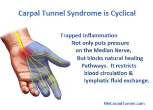 Carpal Tunnel Syndrome is Cyclical