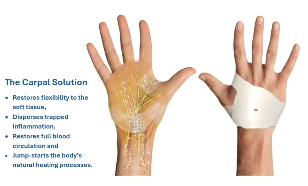 Home 4 How The Carpal Solution Carpal Tunnel Treatment kit works to relieve carpal tunnel symptoms and put CTS in complete remission in 6 weeks.