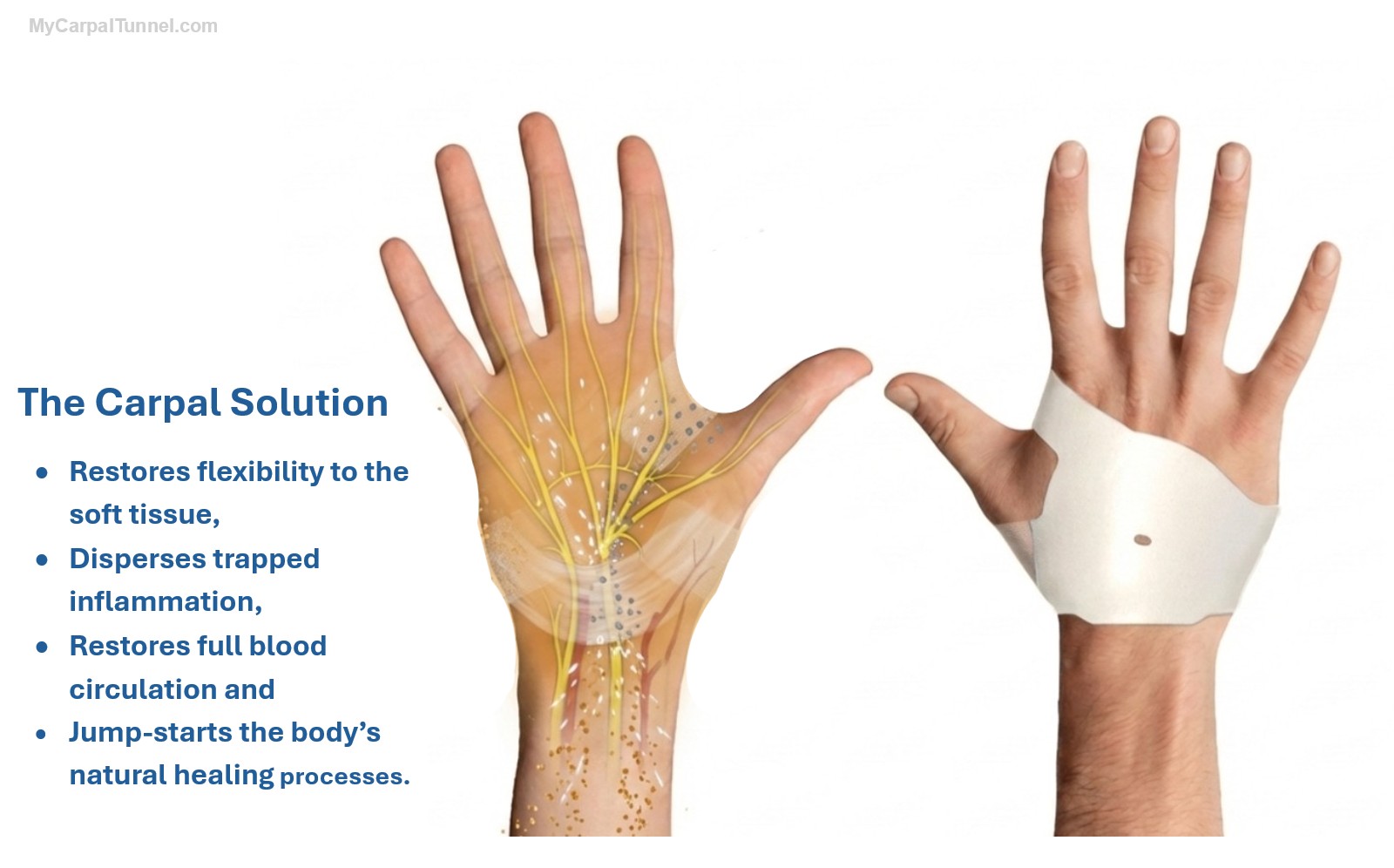 How The Carpal Solution Carpal Tunnel Treatment kit works to relieve carpal tunnel symptoms and put CTS in complete remission in 6 weeks.