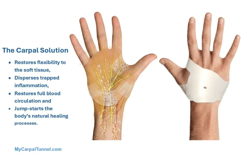 The Carpal Solution Treatment Kit Heals CTS Naturally at home. It is the best medical treatment for Carpal Tunnel. It disperses trapped inflammation and restores flexibility and full blood circulation. It jump-starts your body's natural healing of Carpal Tunnel Syndrome.  This is how the carpal solution works at home during sleep.