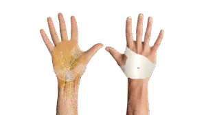 The Carpal Solution restored blood flow, disperses trapped inflammation and jump-starts body's natural healing processes
