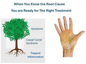 Knowing the Root Cause of Carpal Tunnel Syndrome is Trapped Inflammation makes you ready for the right natural treatment approach.