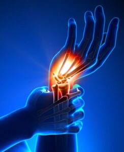 Permanent Nerve Damage and Carpal Tunnel Syndrome takes years of neglect.