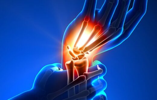 Permanent Nerve Damage and Carpal Tunnel Syndrome takes years of neglect.